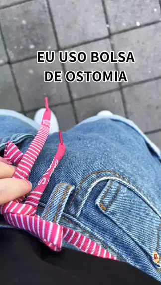 homem com bolsa para ostomia