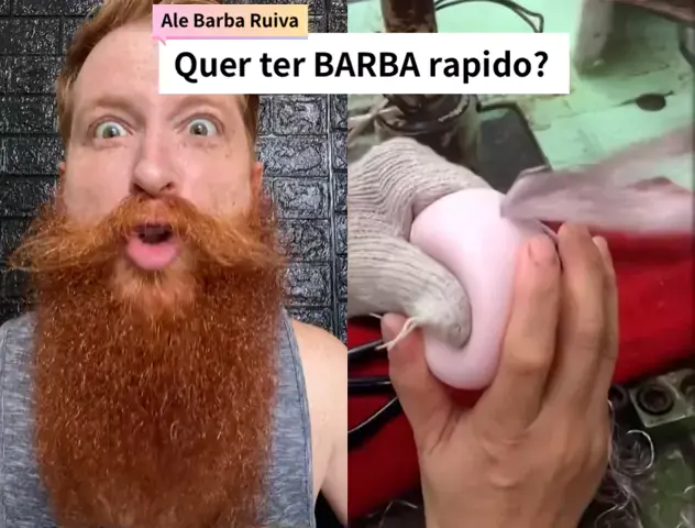 rem dio caseiro para crescer barba r pido Discover