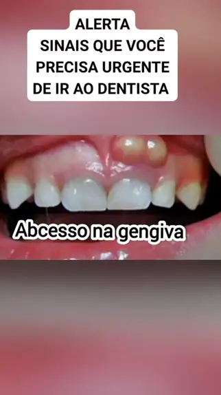 Solange sol 1401 Sol14011976 . udio original criado por Solange sol 1401. sinais que voc precisa ir ao dentista urgente