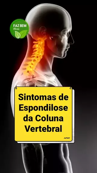 Infográfico de anatomia da coluna vertebral ou curvas da coluna