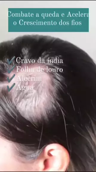 dicas capilares cabelo.e.cia . udio original criado por dicas capilares. J quero testar essa receita crescimentocapilar tonicocapilar cabelolongo quedacapilar