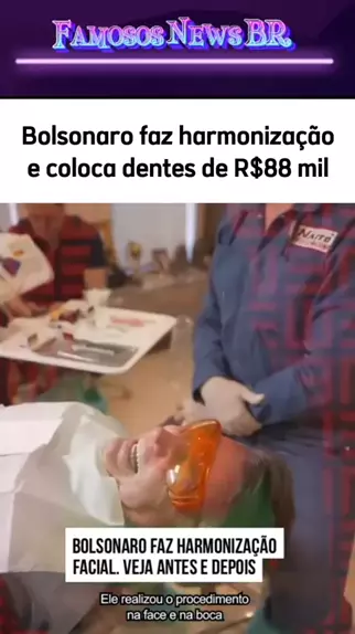 A harmonização facial feita em Jair Bolsonaro: 3 mil reais cada