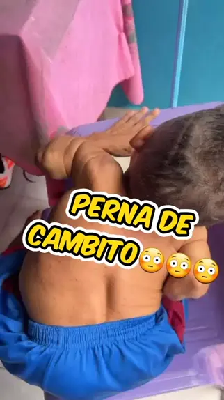 perna de cambito