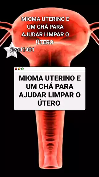 Solange sol 1401 Sol14011976 . udio original criado por Solange sol 1401. MillionQuiz15 topz MIOMA UTERINO E UM CH PARA AJUDAR LIMPAR O TERO