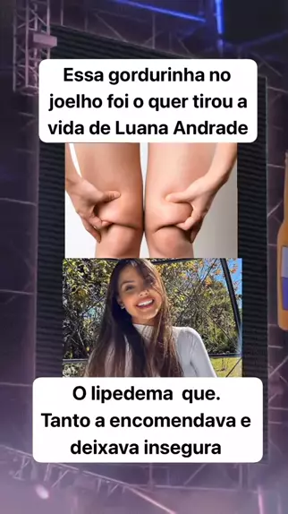 Luana Andrade tinha Lipedema no joelho #entretenimento #luanaandrade