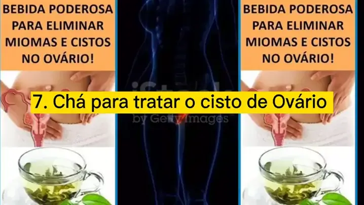 Gerando maternidade IdeiasGN . udio original criado por Gerando maternidade. Ch s para tratar cistos do ov rio minhas e endometriose. chanaturais medicinanatirais