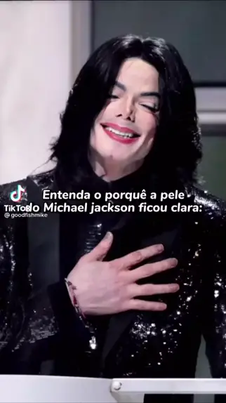 Michael Jackson era inseguro por causa do vitiligo e tentava