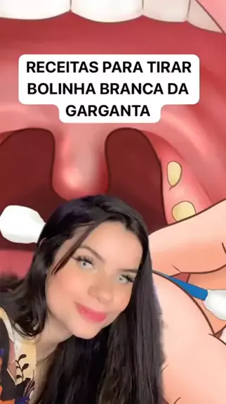 garganta com bolinhas｜Pesquisa do TikTok