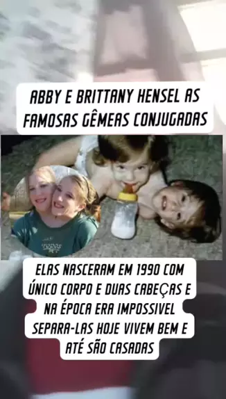 abigail y brittany hensel 2023 casadas