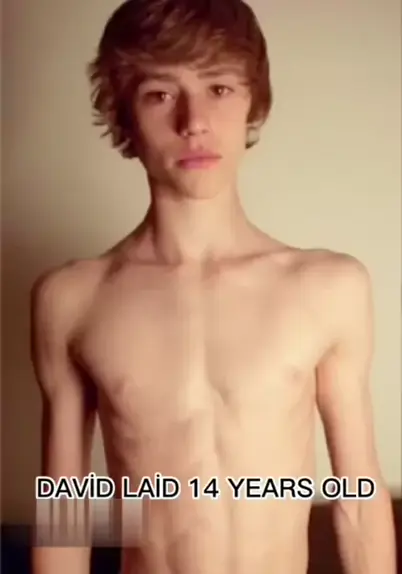 david laid 20 years old