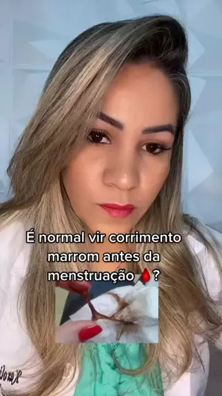 Corrimento marrom antes da menstruação: o que pode ser