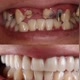 dentes maravilhosos