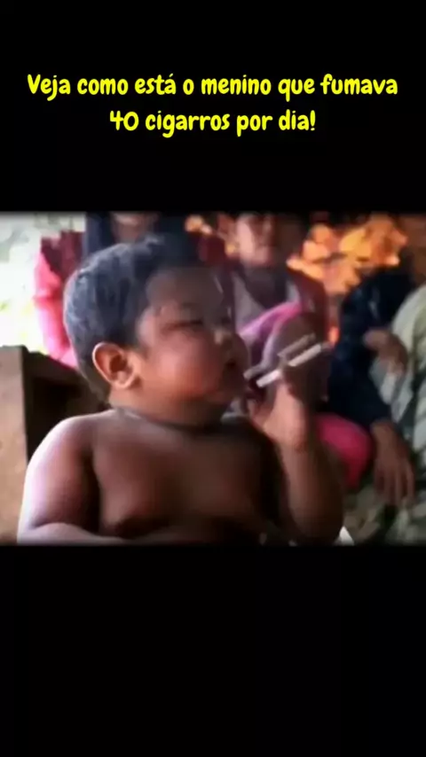 40 cigarros por dia: Veja o que aconteceu com o bebê fumante da