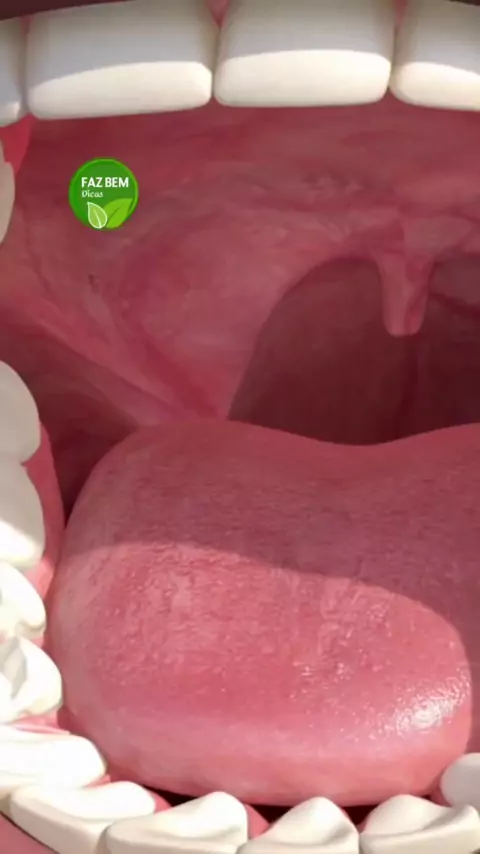 Ja teve bolinha amarela na garganta? #odontologia #odonto