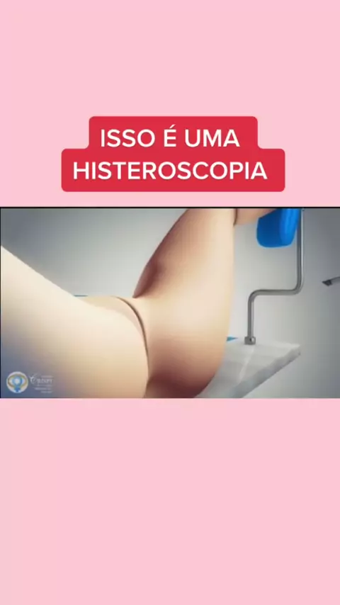 prolapso retal o que causa | Discover