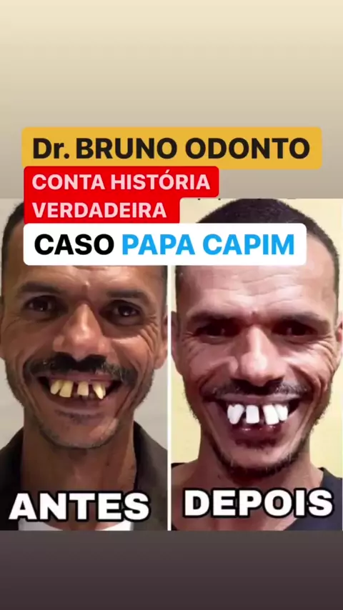 Estalos ao abrir a boca, Bruno Puglisi - Odontologia