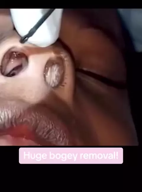 nippyspace virus removal | Discover